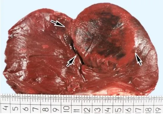 Cardiotons